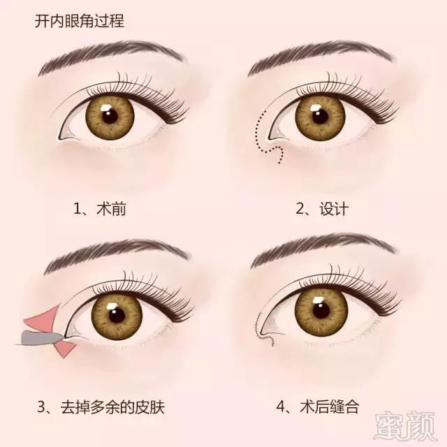 https://img.miyanlife.com/mnt/timg/180328/121A94Y8-3.jpg