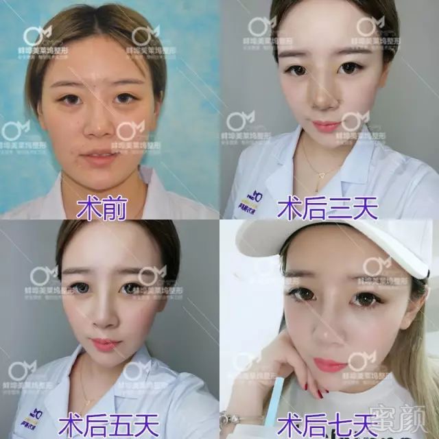 https://img.miyanlife.com/mnt/timg/180328/121F115S-8.jpg