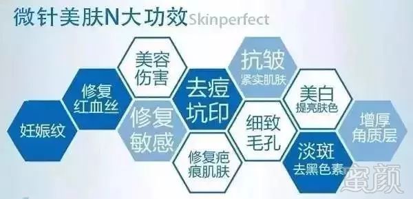 https://img.miyanlife.com/mnt/timg/180328/124134H46-1.jpg