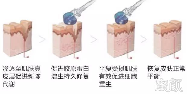 https://img.miyanlife.com/mnt/timg/180328/12413KK8-3.jpg