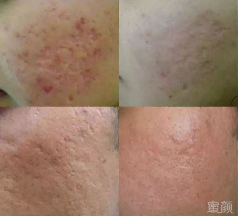 https://img.miyanlife.com/mnt/timg/180328/12413W461-5.jpg