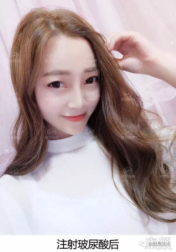 https://img.miyanlife.com/mnt/timg/180328/1309133T6-2.jpg