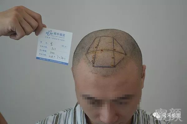 https://img.miyanlife.com/mnt/timg/180328/131Q64414-2.jpg