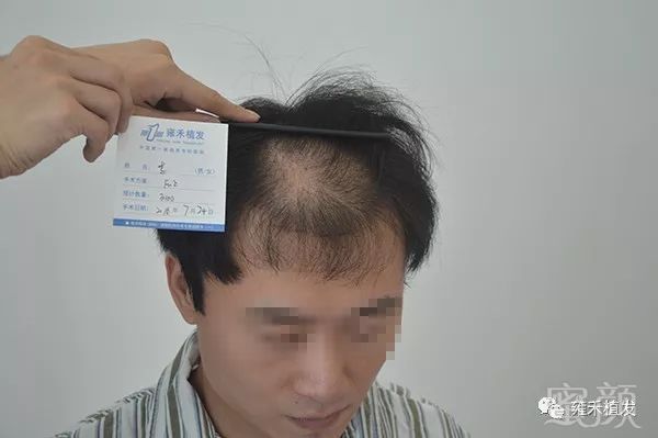 https://img.miyanlife.com/mnt/timg/180328/131QC633-0.jpg
