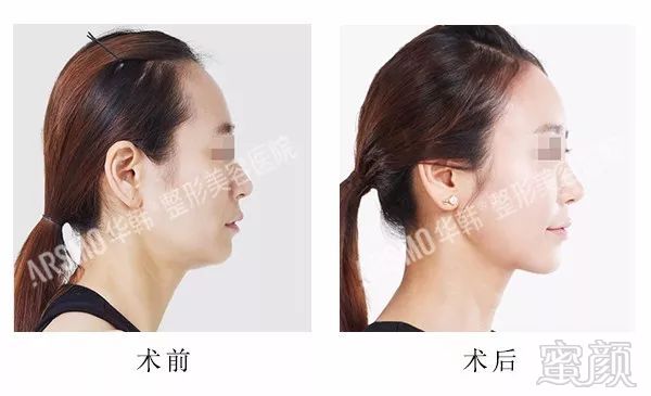 https://img.miyanlife.com/mnt/timg/180329/11145351K-5.jpg