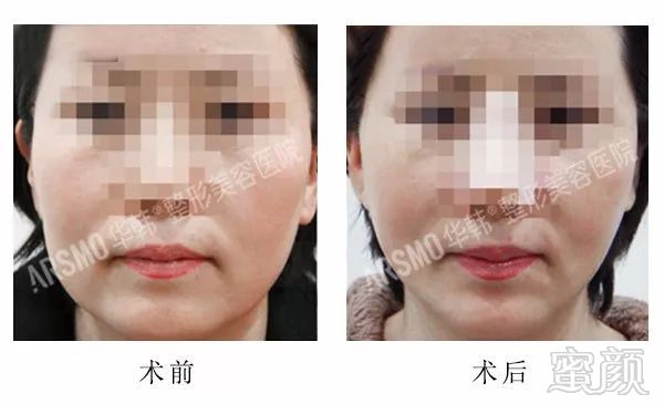 https://img.miyanlife.com/mnt/timg/180329/1114541117-7.jpg