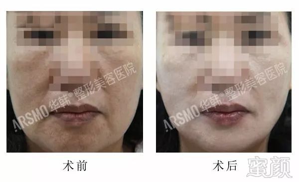 https://img.miyanlife.com/mnt/timg/180329/1114541S0-8.jpg