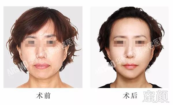 https://img.miyanlife.com/mnt/timg/180329/11145433b-6.jpg