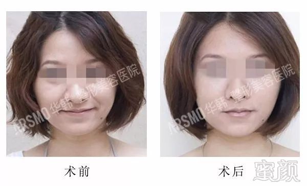 https://img.miyanlife.com/mnt/timg/180329/111454A02-9.jpg