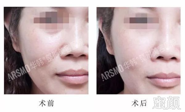 https://img.miyanlife.com/mnt/timg/180329/11145511M-10.jpg