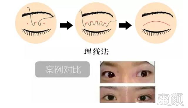 https://img.miyanlife.com/mnt/timg/180329/1140191931-6.jpg