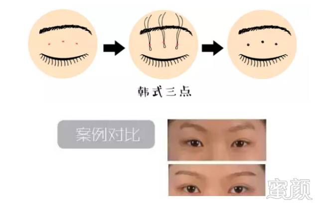 https://img.miyanlife.com/mnt/timg/180329/1140206332-8.jpg