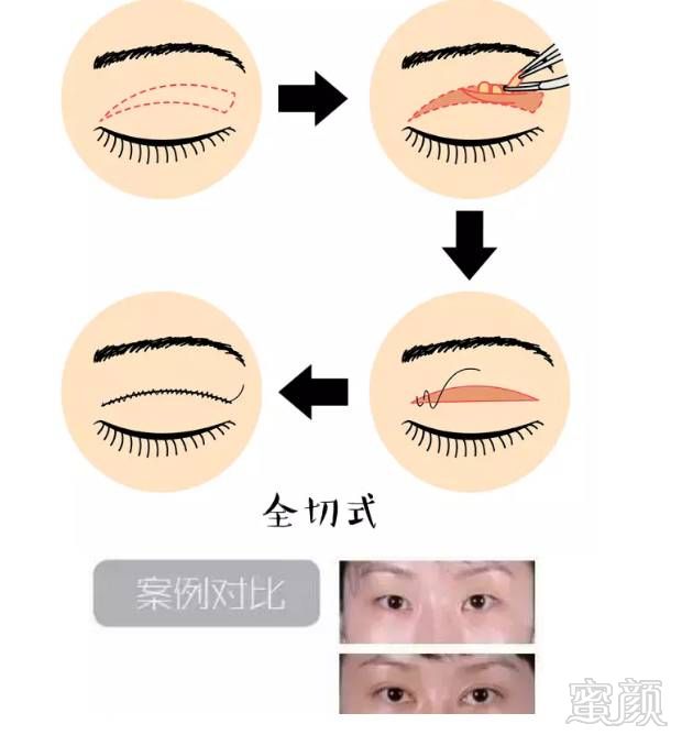 https://img.miyanlife.com/mnt/timg/180329/114020A64-7.jpg
