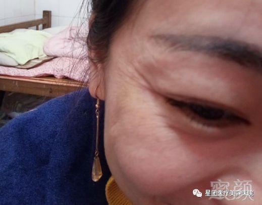 https://img.miyanlife.com/mnt/timg/180329/115G364D-1.jpg