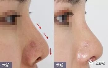 https://img.miyanlife.com/mnt/timg/180329/12005G914-3.jpg
