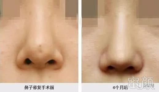 https://img.miyanlife.com/mnt/timg/180329/12005I127-1.jpg