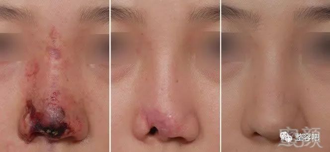 https://img.miyanlife.com/mnt/timg/180329/12011615T-5.jpg