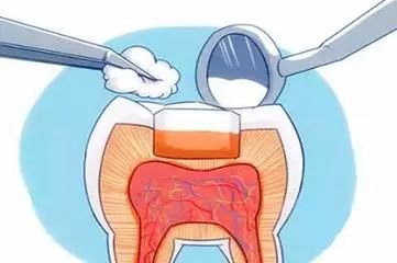 https://img.miyanlife.com/mnt/timg/180329/12034B520-3.jpg
