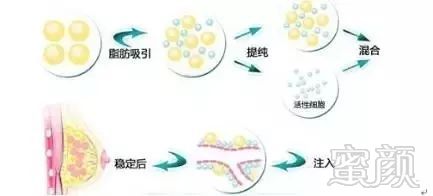 案例图片