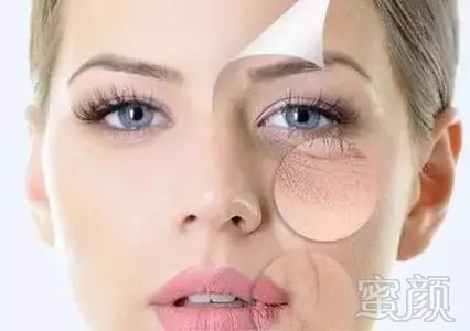 https://img.miyanlife.com/mnt/timg/180329/123Q25D6-1.jpg