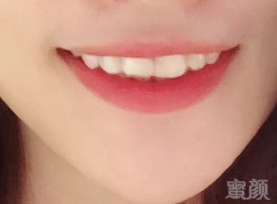 https://img.miyanlife.com/mnt/timg/180329/1243054E7-9.jpg