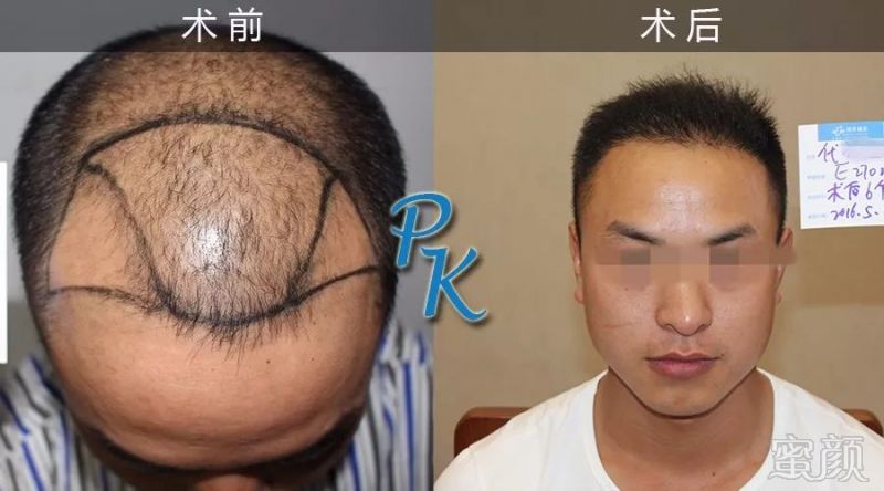 https://img.miyanlife.com/mnt/timg/180329/12431BJ0-1.jpg