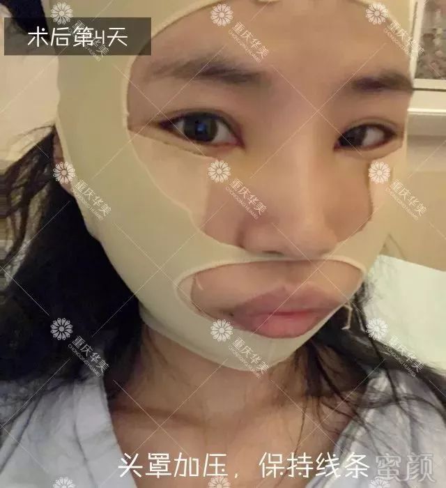 https://img.miyanlife.com/mnt/timg/180329/13052134b-5.jpg
