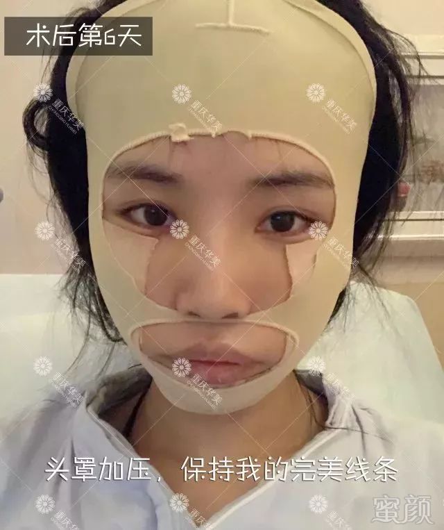 https://img.miyanlife.com/mnt/timg/180329/1305214196-6.jpg