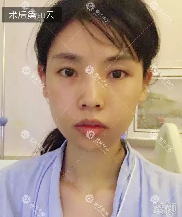 https://img.miyanlife.com/mnt/timg/180329/13052210S-8.jpg