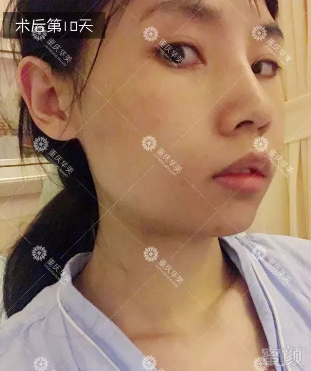 https://img.miyanlife.com/mnt/timg/180329/1305222358-7.jpg