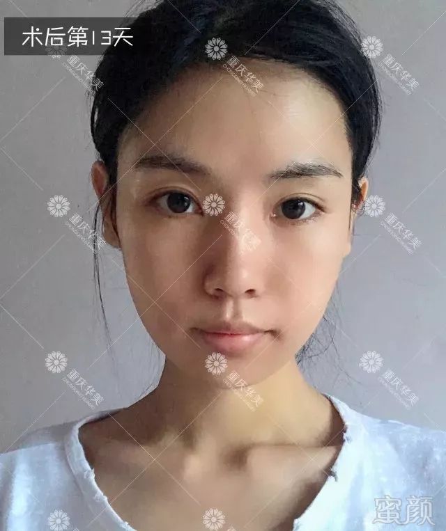 https://img.miyanlife.com/mnt/timg/180329/1305225416-9.jpg
