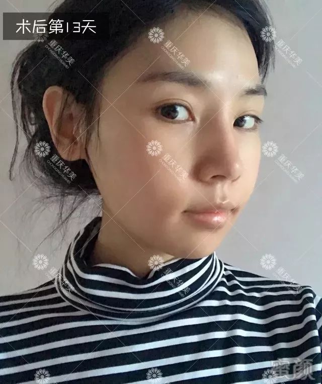 https://img.miyanlife.com/mnt/timg/180329/1305233046-10.jpg