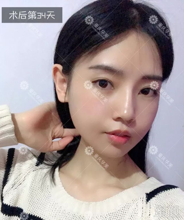 https://img.miyanlife.com/mnt/timg/180329/1305242409-13.jpg