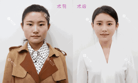 https://img.miyanlife.com/mnt/timg/180329/1305263601-20.gif