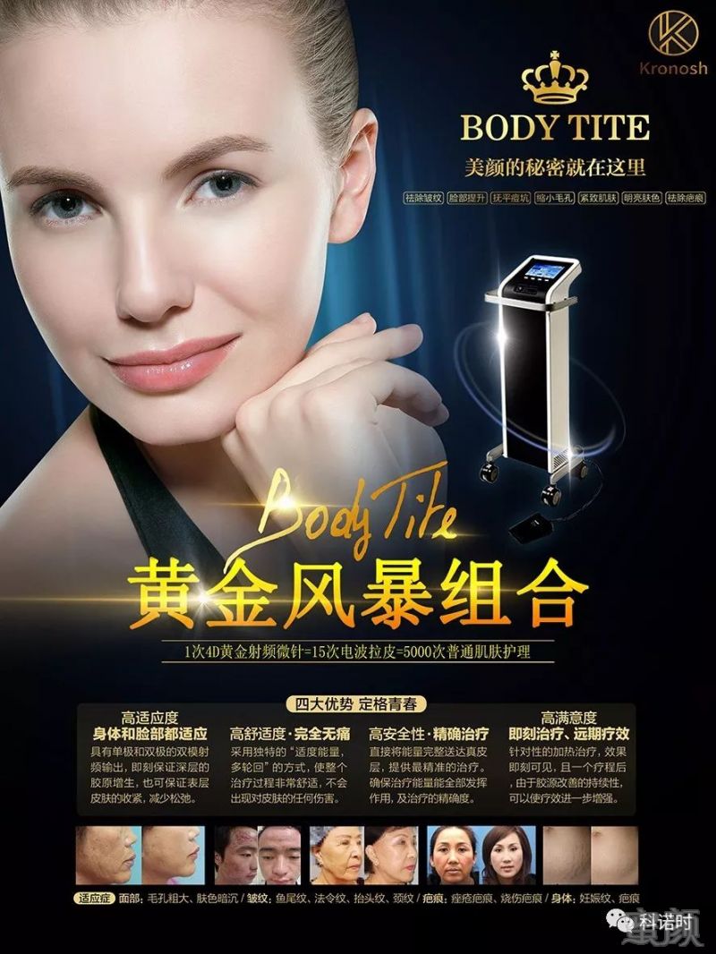 https://img.miyanlife.com/mnt/timg/180329/131FS115-2.jpg