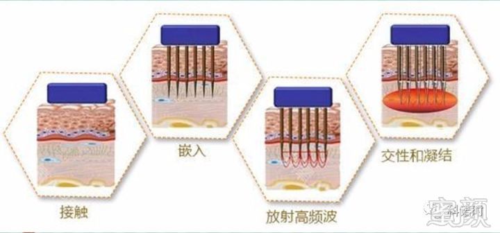 https://img.miyanlife.com/mnt/timg/180329/131FUK7-4.jpg