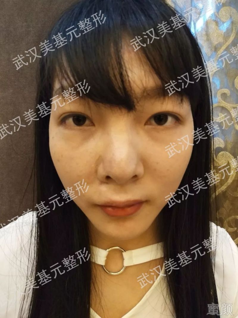 https://img.miyanlife.com/mnt/timg/180330/112530BT-1.jpg