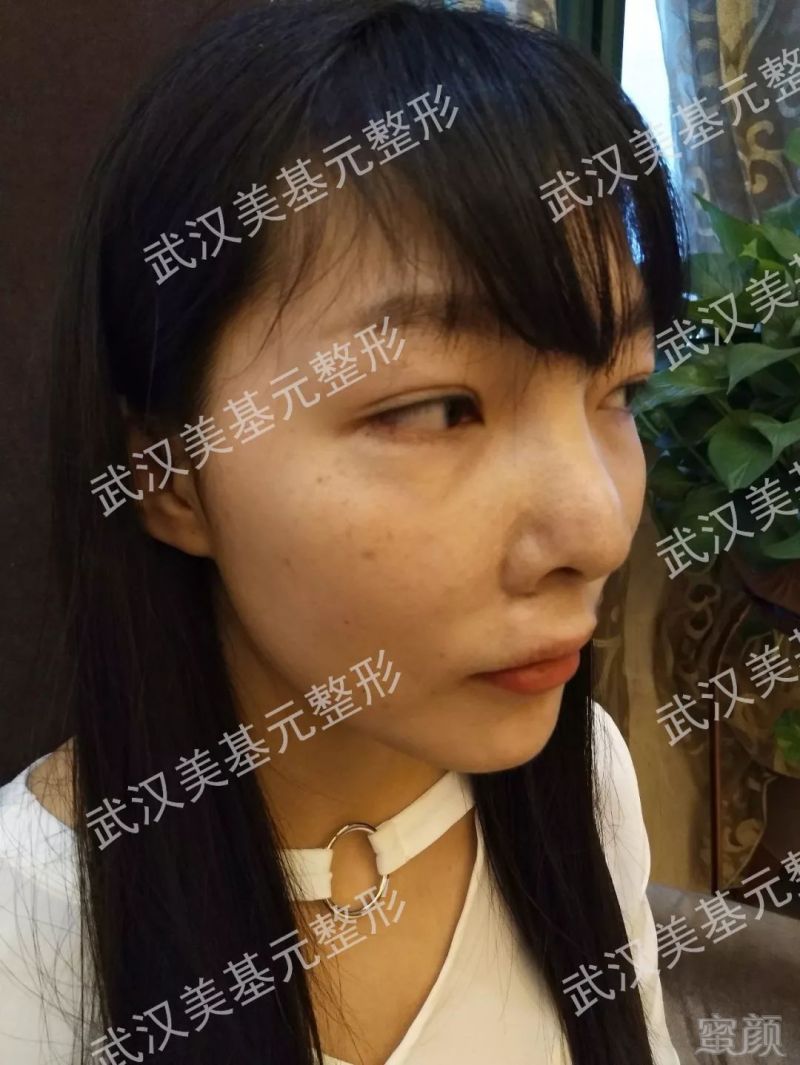 https://img.miyanlife.com/mnt/timg/180330/1125314257-2.jpg