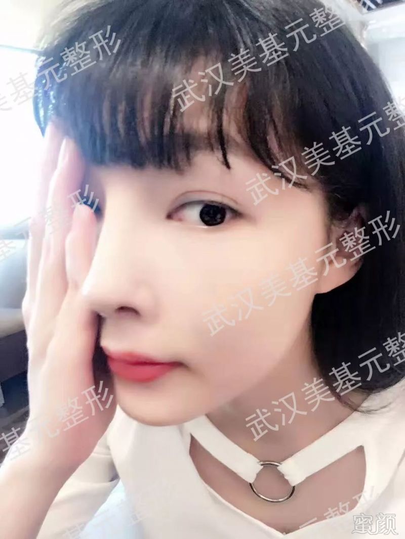 https://img.miyanlife.com/mnt/timg/180330/1125325H0-4.jpg