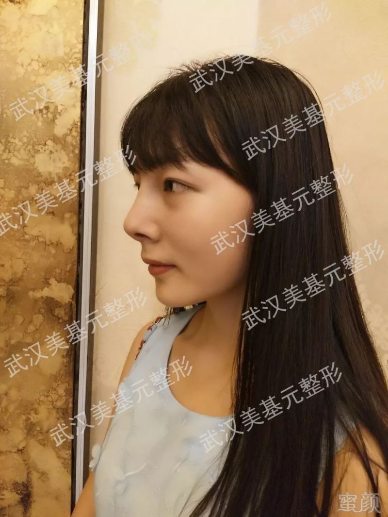 https://img.miyanlife.com/mnt/timg/180330/112533M49-5.jpg