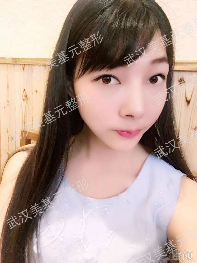 https://img.miyanlife.com/mnt/timg/180330/1125342023-7.jpg