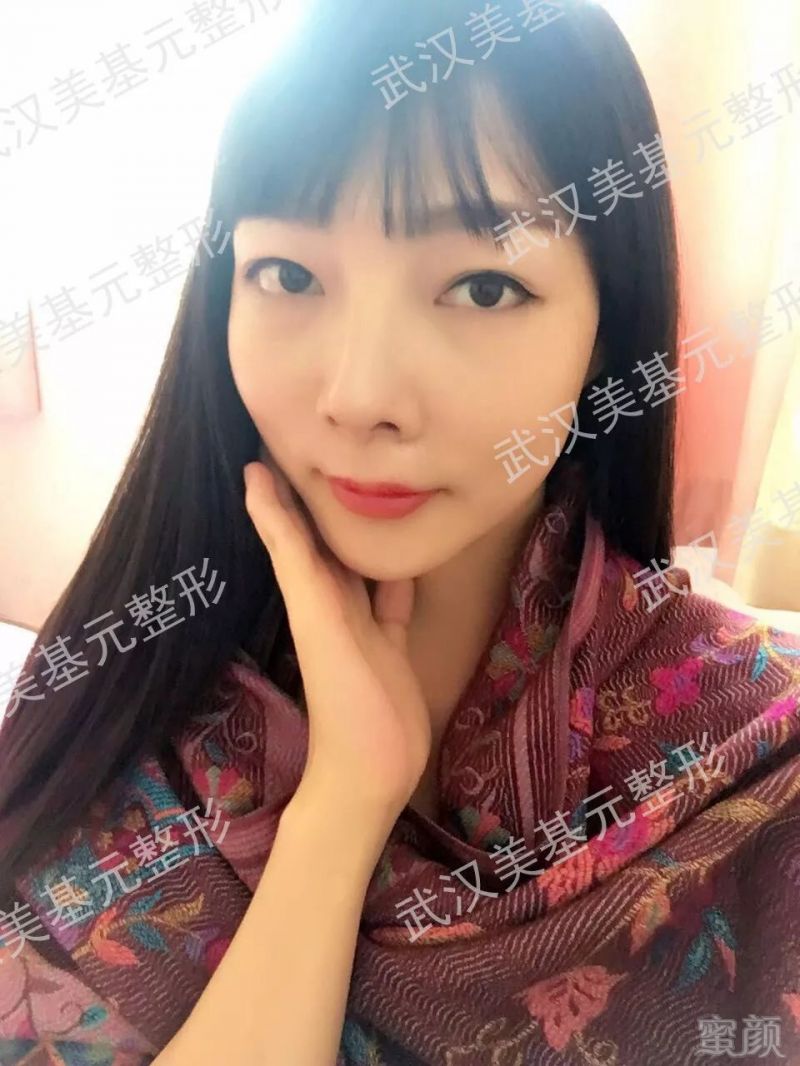 https://img.miyanlife.com/mnt/timg/180330/1125355613-8.jpg