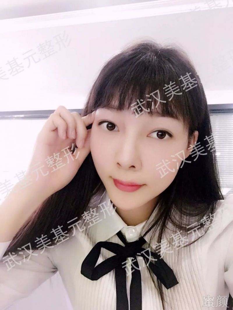 https://img.miyanlife.com/mnt/timg/180330/11253U1M-10.jpg
