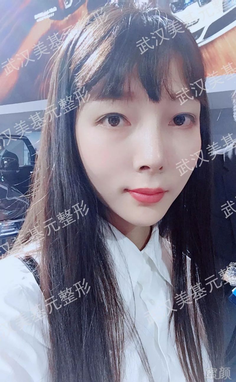 https://img.miyanlife.com/mnt/timg/180330/11254I010-13.jpg