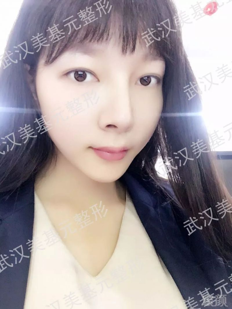 https://img.miyanlife.com/mnt/timg/180330/1125514406-14.jpg