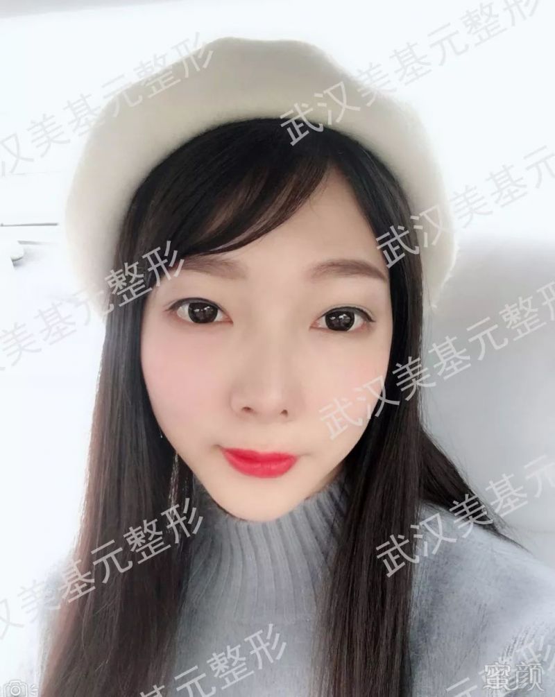https://img.miyanlife.com/mnt/timg/180330/1125535246-15.jpg
