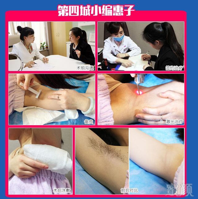https://img.miyanlife.com/mnt/timg/180330/11294SP5-5.jpg