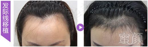 https://img.miyanlife.com/mnt/timg/180330/11302aa8-1.jpg