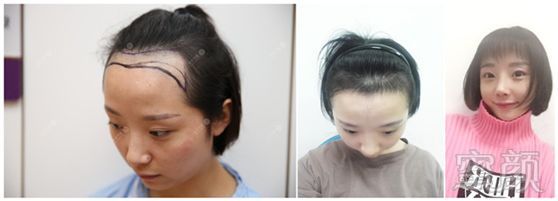 https://img.miyanlife.com/mnt/timg/180330/113030OD-6.jpg