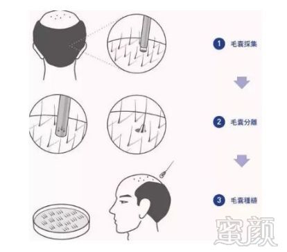 https://img.miyanlife.com/mnt/timg/180330/1130443b3-0.jpg